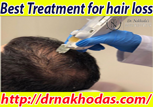 Are you facing issues with hair loss?