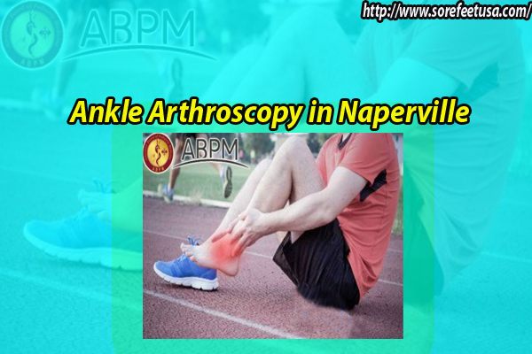 Everything You Need To Know About Ankle Arthroscopy In Naperville