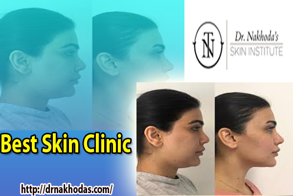 6 Quick Tips To Choose Best Skin Clinic
