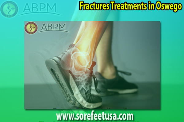 What Are The Symptoms, Treatment And Prevention Of Bone Fractures?