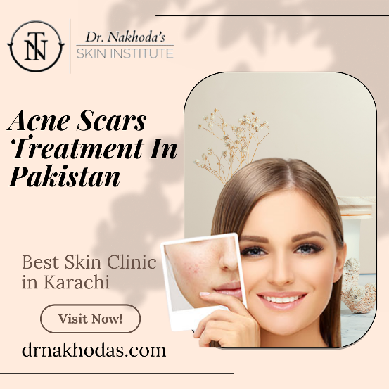 Long-Term Benefits of Face Lift Treatment In Karachi