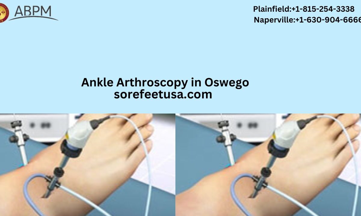 Busting Common Misinformation About Ankle Arthroscopy & Wart Treatment In Oswego, IL