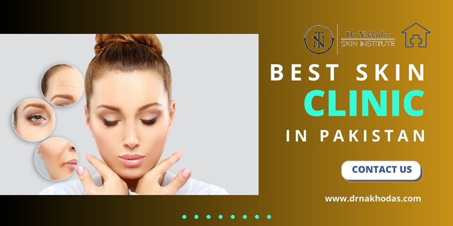 Unveiling The Best Skin Clinic In Pakistan For Acne Treatment: Your Ultimate Guide