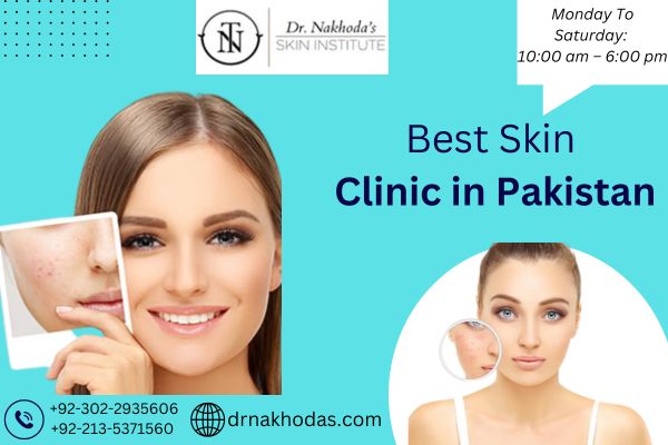 Finding Best Dermatologist In Karachi For Your Acne Woes: A Comprehensive Guide