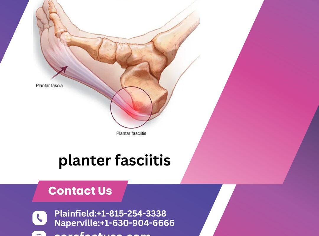 Heel Pain No More: Expert Podiatrists Provide Comprehensive Plantar Fasciitis Treatment