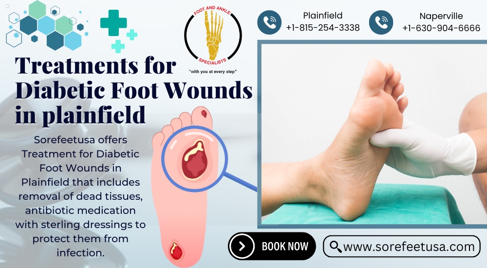 Stepping Towards Healing: Effective Treatments for Diabetic Foot Wounds