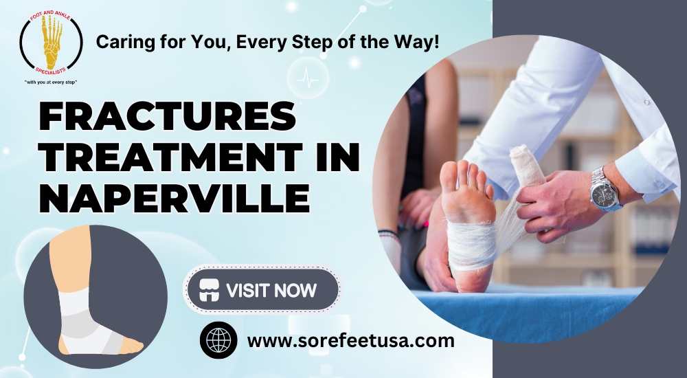 Understanding Fracture Treatment: A Comprehensive Guide