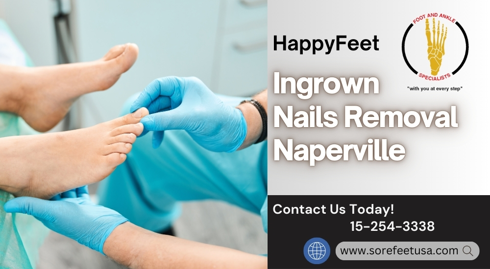 Understanding Ingrown Nails: Causes, Treatment, and Prevention