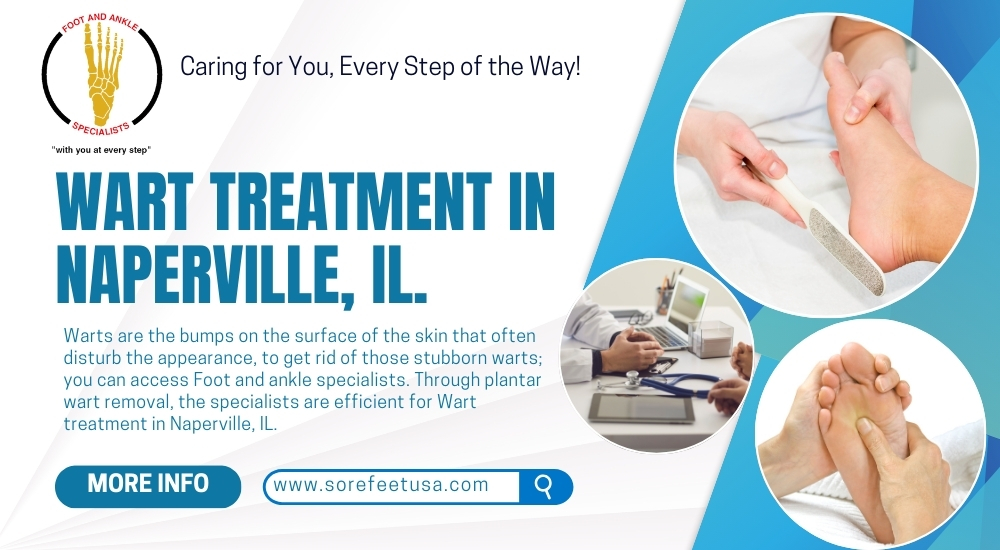 Wart Treatment: Simple and Effective Ways to Get Rid of Warts