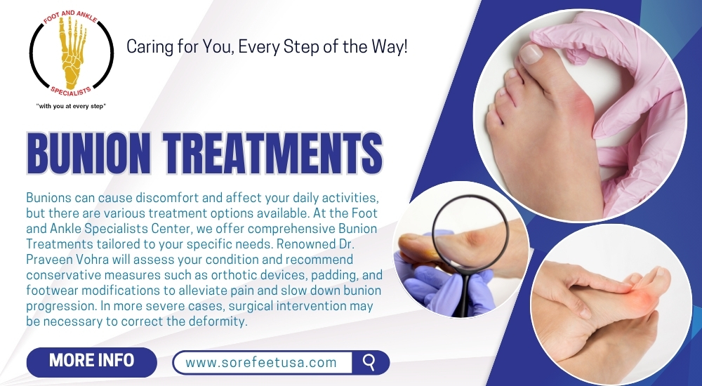 Early Symptoms of Bunion That Shouldn’t Be Ignored